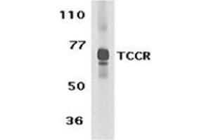 Western blot analysis of TCCR expression in human spleen tissue lysate with this product at 1 μg /ml.
