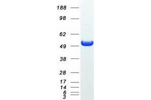 Western Blotting (WB) image for 5'-Nucleotidase Domain Containing 1 (NT5DC1) protein (Myc-DYKDDDDK Tag) (ABIN2727672)