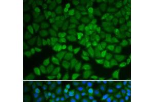 Immunofluorescence analysis of A549 cells using GSS Polyclonal Antibody (Glutathione Synthetase 抗体)