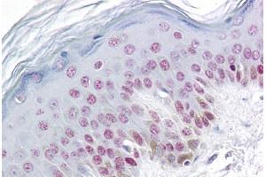 Human Skin: Formalin-Fixed, Paraffin-Embedded (FFPE) (RBM3 抗体  (AA 1-81))