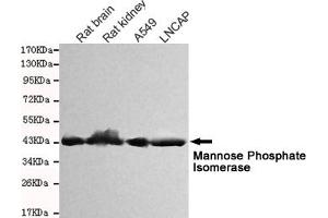 Western blot detection of Mannose Phosphate Isomerase in Rat kidney,Rat brain,A549 and Lncap cell lysates and using Mannose Phosphate Isomerase mouse mAb (1:1000 diluted). (MPI 抗体)