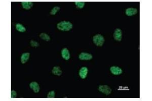 Immunostaining analysis in HeLa cells. (CBP 抗体)