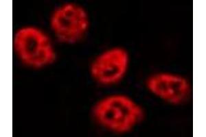 ABIN6275834 staining HepG2 by IF/ICC. (TBX3 抗体  (Internal Region))