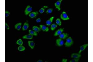 Immunofluorescence staining of A549 cells with ABIN7170348 at 1:200, counter-stained with DAPI. (SNX12 抗体  (AA 2-172))