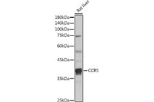 Western blot analysis of extracts of Rat liver, using CCR5 antibody (ABIN7266307) at 1:1000 dilution. (CCR5 抗体  (AA 100-200))