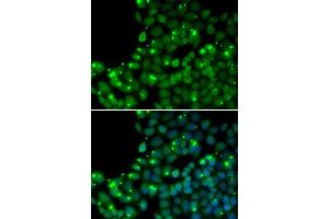 Immunofluorescence analysis of U20S cell using MGMT antibody. (MGMT 抗体  (AA 1-207))