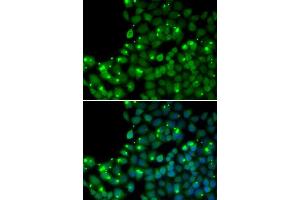 Immunofluorescence analysis of U20S cell using MGMT antibody. (MGMT 抗体  (AA 1-207))