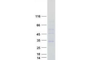 Western Blotting (WB) image for Ceroid-Lipofuscinosis, Neuronal 6, Late Infantile, Variant (CLN6) protein (Myc-DYKDDDDK Tag) (ABIN2712884)