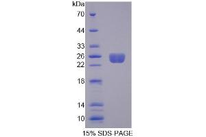 SDS-PAGE analysis of Rat ARHGEF7 Protein. (ARHGEF7 蛋白)