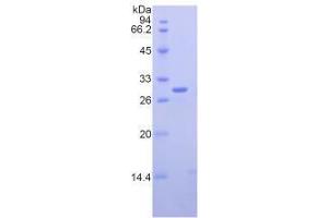 SDS-PAGE analysis of Mouse Nucleolin Protein. (Nucleolin Protein (NCL))