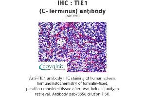 Image no. 1 for anti-tyrosine Kinase with Immunoglobulin-Like and EGF-Like Domains 1 (TIE1) (C-Term) antibody (ABIN1740068) (TIE1 抗体  (C-Term))