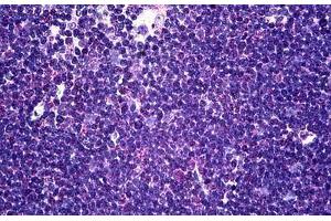 Human Thymus: Formalin-Fixed, Paraffin-Embedded (FFPE) (CD58 抗体  (AA 1-241))