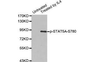Western blot analysis of extracts from K562 cells using Phospho-STAT5A-S780 antibody. (STAT5A 抗体  (pSer780))