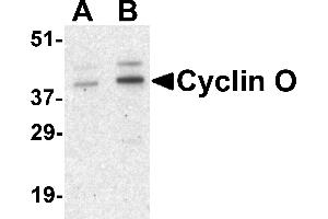 Western blot analysis of UNG2 in human bladder tissue lysate with UNG2 antibody at (A) 1 and (B) 2 µg/mL. (Cyclin O 抗体  (Middle Region))
