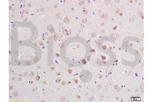Formalin-fixed and paraffin embedded rat brain labeled with Anti-CLCN3 Polyclonal Antibody, Unconjugated (ABIN1386131) at 1:200 followed by conjugation to the secondary antibody and DAB staining (CLCN3 抗体  (AA 81-180))