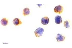 Immunocytochemical staining of AIF in Jurkat cells with AIF(NT) antibody at 2 μg/ml. (AIF 抗体)