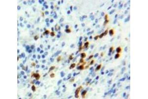 Used in DAB staining on fromalin fixed paraffin-embedded Spleen tissue (Retinoblastoma 1 抗体  (AA 639-778))