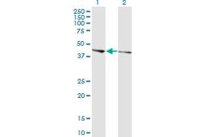 Western Blot analysis of PHACTR3 expression in transfected 293T cell line by PHACTR3 monoclonal antibody (M02), clone 4A5. (PHACTR3 抗体  (AA 92-179))
