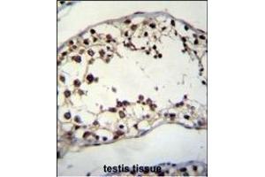 PIH1D2 Antibody (C-term) (ABIN655237 and ABIN2844841) immunohistochemistry analysis in formalin fixed and paraffin embedded human testis tissue followed by peroxidase conjugation of the secondary antibody and DAB staining. (PIH1D2 抗体  (C-Term))