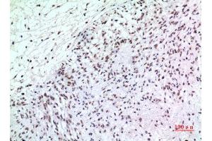 Immunohistochemistry (IHC) analysis of paraffin-embedded Human Brain, antibody was diluted at 1:100. (P57 (Ser24) 抗体)