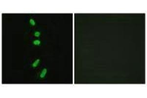 Immunofluorescence analysis of HeLa cells, using SF1 (Ab-82) antibody. (Splicing Factor 1 抗体  (Ser82))