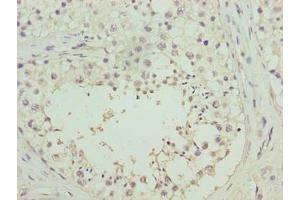 Immunohistochemistry of paraffin-embedded human testis tissue using ABIN7166851 at dilution of 1:100 (RHPN1-AS1 抗体  (AA 1-59))