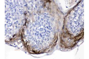Elafin/Skalp was detected in paraffin-embedded sections of human tonsil tissues using rabbit anti- Elafin/Skalp Antigen Affinity purified polyclonal antibody (Catalog # ) at 1 µg/mL. (PI3 抗体  (AA 61-117))