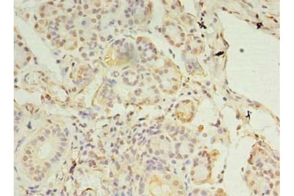 CCDC109B 抗体  (Regulatory Subunit)