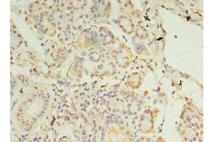 Immunohistochemistry of paraffin-embedded human pancreatic tissue using ABIN7146318 at dilution of 1:100 (CCDC109B 抗体  (Regulatory Subunit))
