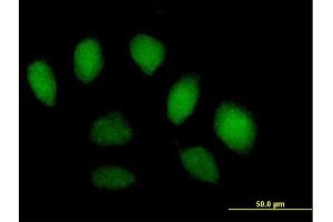 Immunofluorescence of purified MaxPab antibody to SFMBT1 on HeLa cell. (SFMBT1 抗体  (AA 1-866))