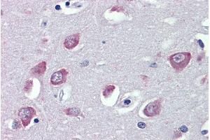 Immunohistochemistry (IHC) image for anti-Transient Receptor Potential Cation Channel, Subfamily C, Member 1 (TRPC1) (Internal Region) antibody (ABIN6391351)