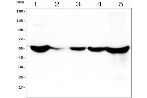 Western blot analysis of ALDH2 using anti-ALDH2 antibody (ABIN7603107). (ALDH2 抗体  (N-Term))