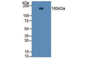 Figure. (Angiotensin I Converting Enzyme 1 抗体  (AA 814-1071))