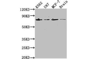 Western Blot Positive WB detected in: K562 whole cell lysate, U87 whole cell lysate, MCF-7 whole cell lysate, Rat brain tissue All lanes: LMNA antibody at 1:2000 Secondary Goat polyclonal to rabbit IgG at 1/50000 dilution Predicted band size: 75, 66, 71, 64, 63, 70 kDa Observed band size: 75 kDa (Lamin A/C 抗体  (AA 385-572))