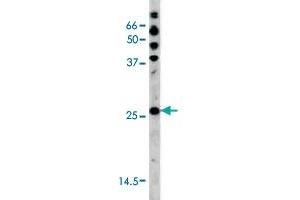 The CDKN1B (phospho S178) polyclonal antibody  is used in Western blot to detect Phospho-CDKN1B-S178 in HL-60 tissue lysate (CDKN1B 抗体  (pSer178))