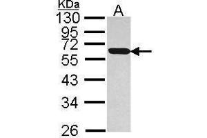 WB Image Sample (30 ug of whole cell lysate) A: Hep G2 , 12% SDS PAGE antibody diluted at 1:1000 (PDIA5 抗体)