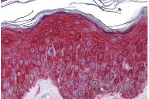 Human Skin: Formalin-Fixed, Paraffin-Embedded (FFPE) (KREMEN1 抗体  (AA 71-120))