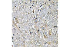 Immunohistochemistry of paraffin-embedded rat brain using PLCG1 Antibody. (Phospholipase C gamma 1 抗体)
