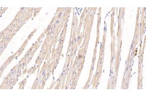 Detection of KNT1 in Rat Heart Tissue using Monoclonal Antibody to T-Kininogen 1 (KNT1) (KNG1 抗体  (AA 378-430))