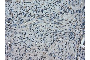Immunohistochemical staining of paraffin-embedded Ovary tissue using anti-TMEM100mouse monoclonal antibody. (TMEM100 抗体)