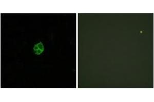 Immunofluorescence analysis of HuvEc cells, using GPR151 Antibody. (GPR151 抗体  (AA 370-419))