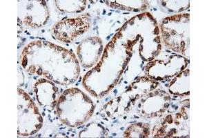 Immunohistochemical staining of paraffin-embedded Kidney tissue using anti-PLEK mouse monoclonal antibody. (Pleckstrin 抗体)