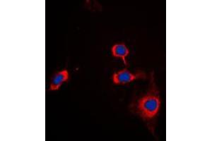 Immunofluorescent analysis of CD172a staining in THP1 cells. (SIRPA 抗体  (C-Term))