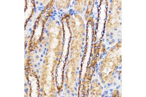 Immunohistochemistry of paraffin-embedded Rat kidney using Mitofusin 2 Rabbit pAb (ABIN6133825, ABIN6143800, ABIN6143803 and ABIN6216518) at dilution of 1:100 (40x lens). (MFN2 抗体  (AA 500-600))