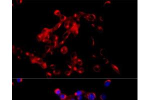 Immunofluorescence (IF) image for anti-Coatomer Protein Complex, Subunit beta 2 (COPB2) antibody (ABIN7011528)