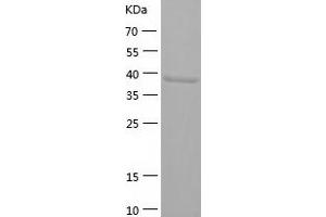 Western Blotting (WB) image for Alcohol Dehydrogenase 1C (Class I), gamma Polypeptide (ADH1C) (AA 1-375) protein (His tag) (ABIN7121766) (ADH1C Protein (AA 1-375) (His tag))