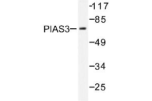 Image no. 1 for anti-Protein Inhibitor of Activated STAT, 3 (PIAS3) antibody (ABIN271953) (PIAS3 抗体)