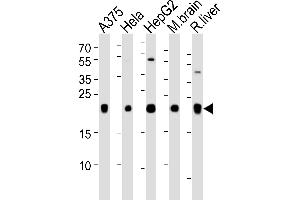 Western blot analysis of lysates from A375, Hela, HepG2 cell line, mouse brain and rat liver tissue lysate(from left to right), using ITPA Antibody at 1:1000 at each lane. (ITPA 抗体  (N-Term))