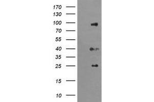 Image no. 1 for anti-Ubiquitin Specific Peptidase 16 (USP16) (AA 137-466) antibody (ABIN1490917) (USP16 抗体  (AA 137-466))