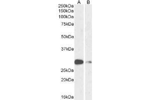 ABIN6391392 (1µg/ml) staining of Mouse (A) and Rat (B) Lung lysate (35µg protein in RIPA buffer). (ASCL1 抗体  (AA 79-91))
